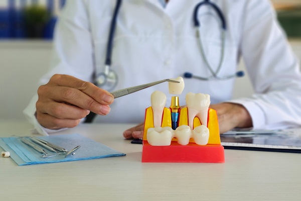 When Is Getting A Dental Crown Necessary?