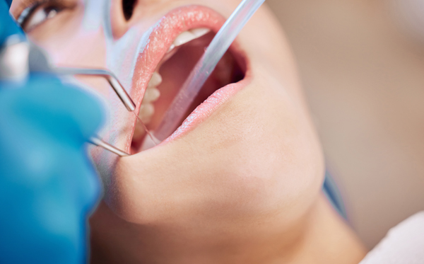 When And Why Tooth Extractions Are Necessary